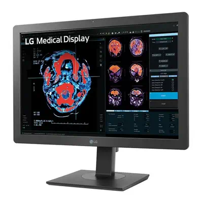 LG 24HR513C-B écran plat de PC 61 cm (24") 1920 x 1080 pixels Full HD Noir - Ecran Ordinateur - visuel 2